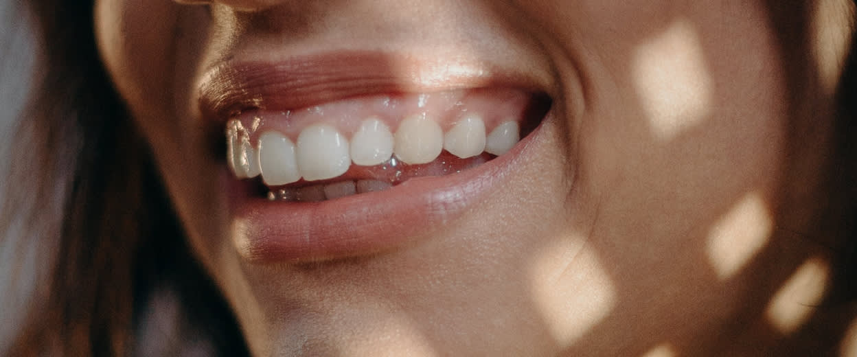 A close-up view of a smiling woman’s healthy white teeth – Viome Oral Health Intelligence Test